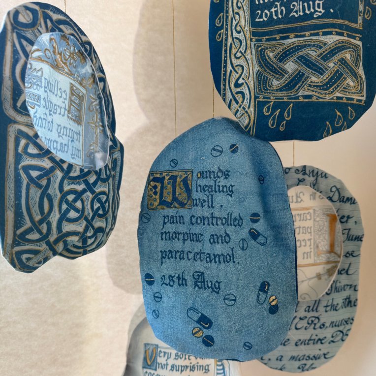 Artist Lois Blackburn's Stoma Bag Covers, Cyanotype on fabric. Inspired by Illuminated manuscripts and celtic knots.