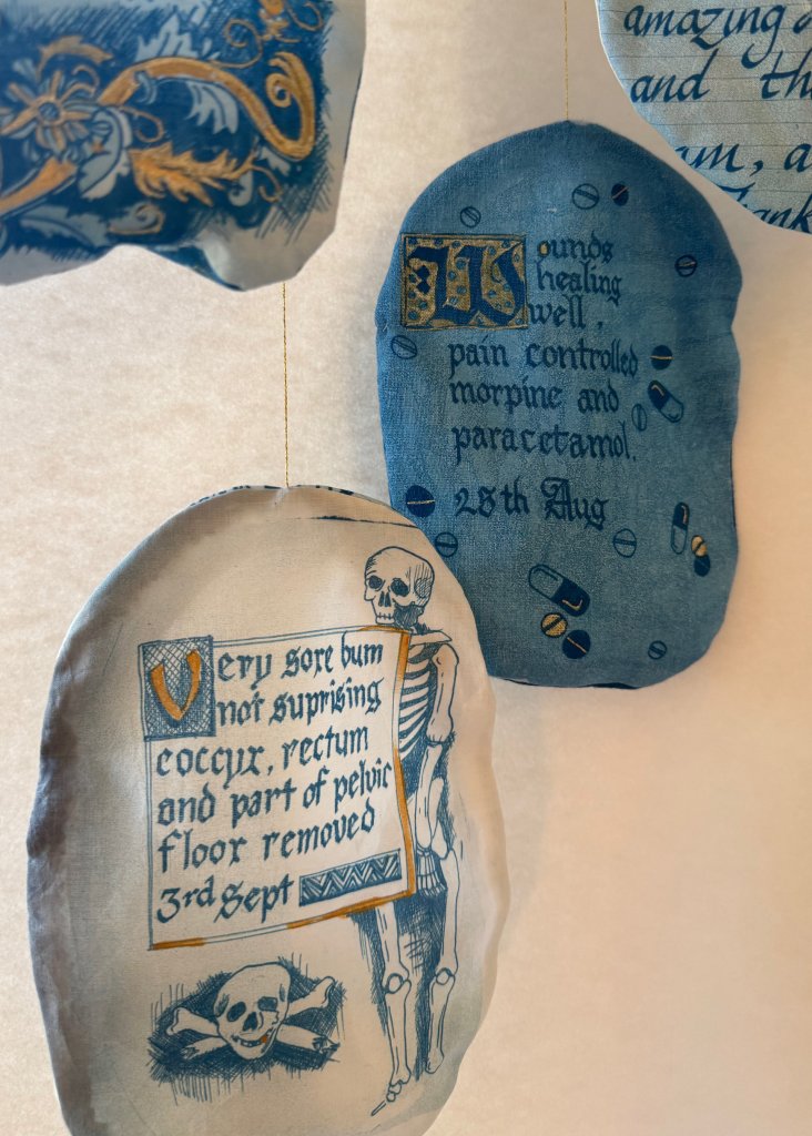 Stoma bag cover, cyanotype on fabric with hand calligraphy and celtic knot illustration, part of Under Repair series by Lois Blackburn.